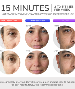 ODELYNE® ADARA SERIES™ LITE | LED LIGHT THERAPY MASK