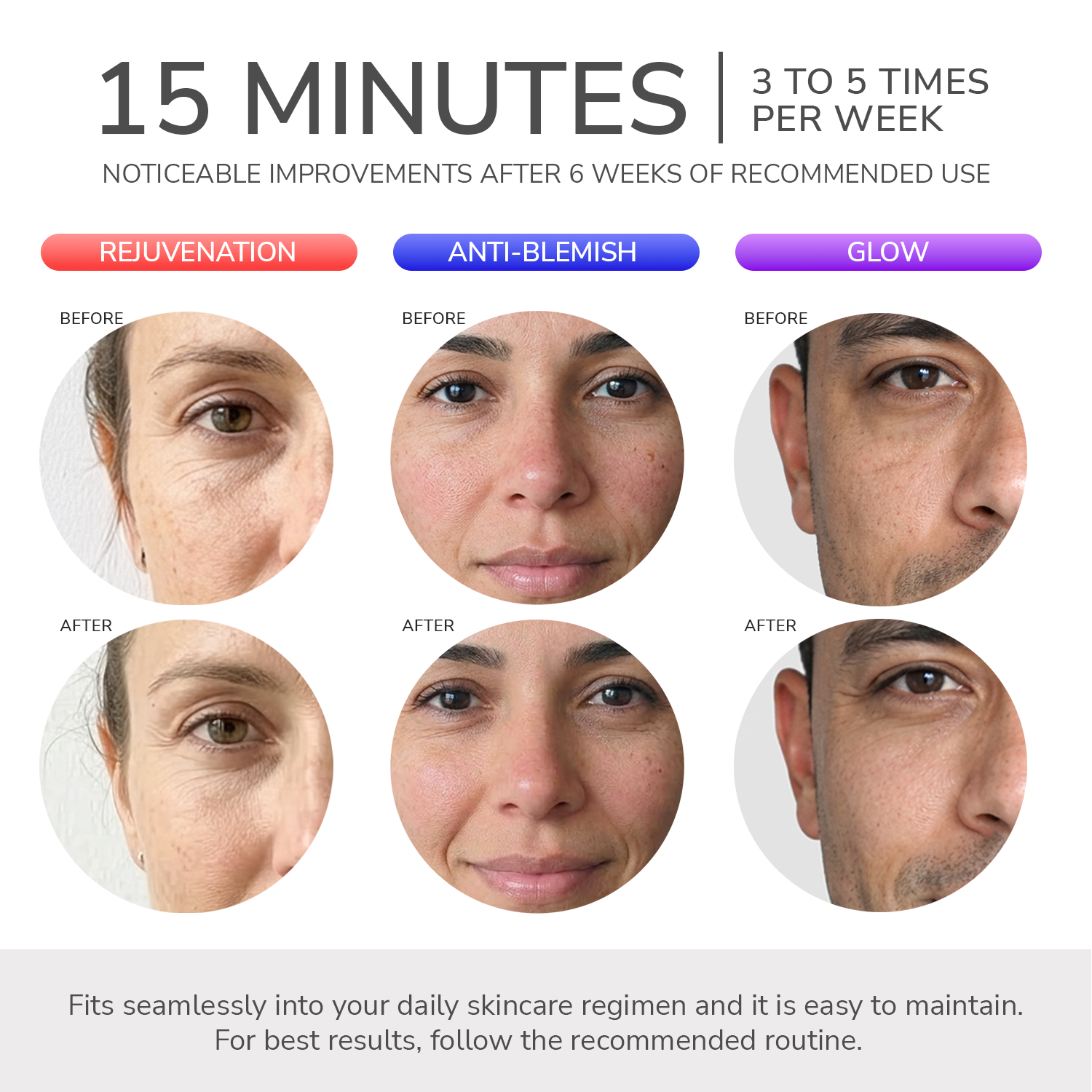 ODELYNE® ADARA SERIES™ LITE | LED LIGHT THERAPY MASK