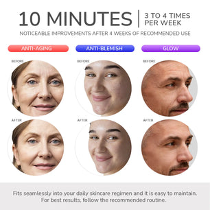 ODELYNE® ADARA SERIES™ PRO | LED LIGHT THERAPY MASK Odelyne