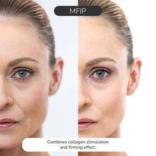 ODELYNE® ILLUME™ | Appareil de massage pour le visage | Appareil de raffermissement de la peau par radiofréquence pour la tonification du visage à domicile | EMS Microcurrent Facial & Collagen Boosting Odelyne