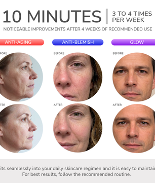 ODELYNE® ADARA SERIES™ PRO | LED-VALOHOITONAAMIO