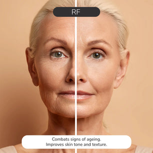 ODELYNE® ILLUME™ | Appareil de massage pour le visage | Appareil de raffermissement de la peau par radiofréquence pour la tonification du visage à domicile | EMS Microcurrent Facial & Collagen Boosting Odelyne