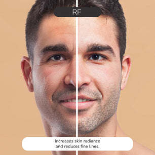 ODELYNE® ILLUME™ | Appareil de massage pour le visage | Appareil de raffermissement de la peau par radiofréquence pour la tonification du visage à domicile | EMS Microcurrent Facial & Collagen Boosting Odelyne