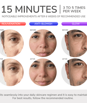 ODELYNE® ADARA SERIES™ LITE | MASCARILLA TERAPÉUTICA CON LUZ LED - Odelyne