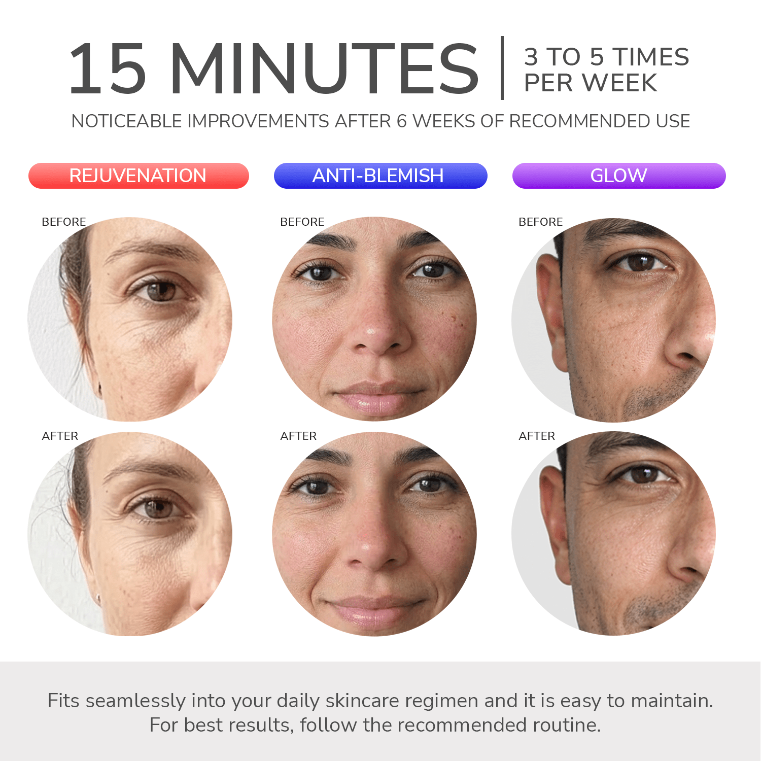 ODELYNE® ADARA SERIES™ LITE | MASCARILLA TERAPÉUTICA CON LUZ LED - Odelyne