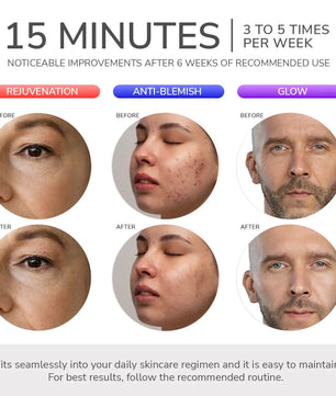 ODELYNE® ADARA SERIES™ LITE | LED LIGHT THERAPY MASK - Odelyne