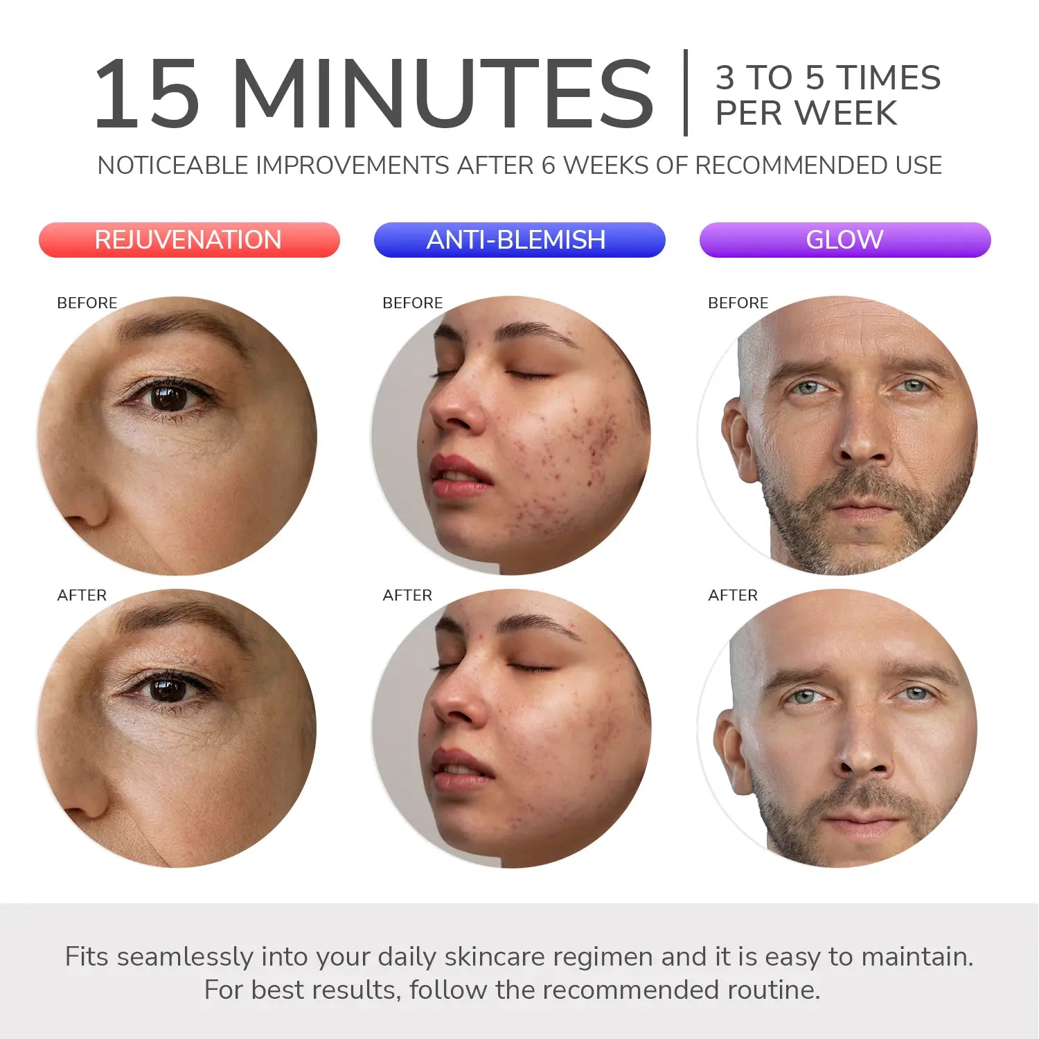 ODELYNE® ADARA SERIES™ LITE | LED LIGHT THERAPY MASK - Odelyne