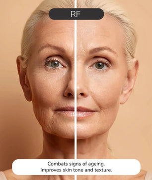 ODELYNE® ILLUME™ | Gesichtsmassagegerät | RF Radiofrequenz - Odelyne