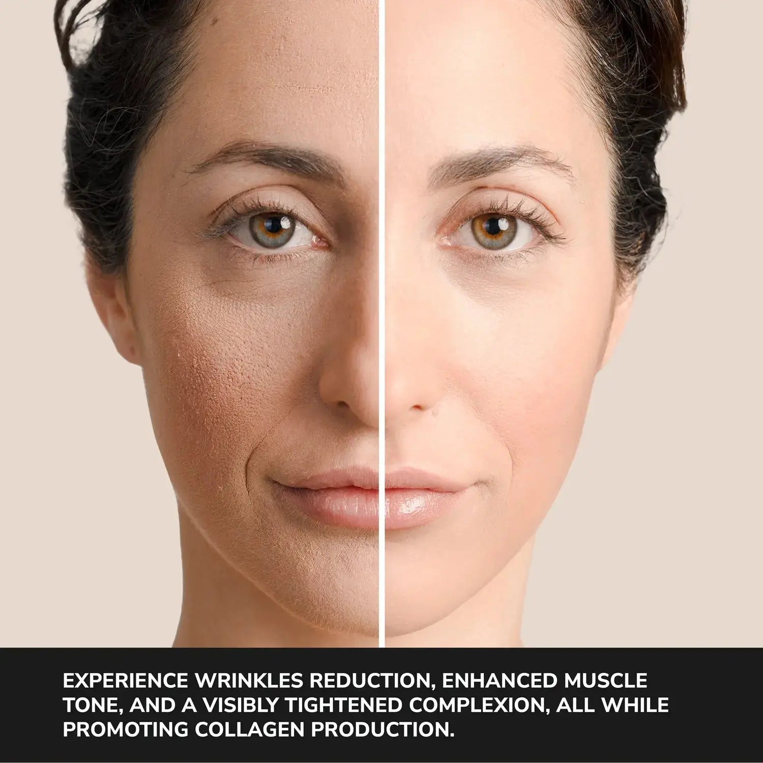 ODELYNE® Face Massager | RF Radio Frequency Skin Tightening Facial