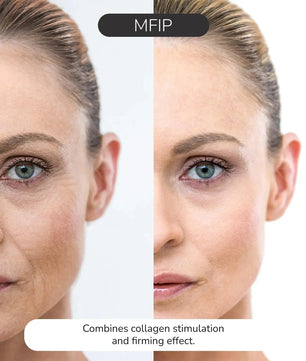 ODELYNE® ILLUME™ | Gesichtsmassagegerät | RF Radiofrequenz - Odelyne