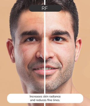 ODELYNE® ILLUME™ | Gesichtsmassagegerät | RF Radiofrequenz - Odelyne