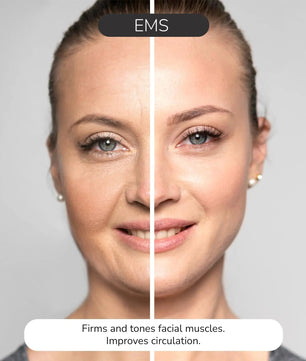 ODELYNE® ILLUME™ | Gesichtsmassagegerät | RF Radiofrequenz - Odelyne