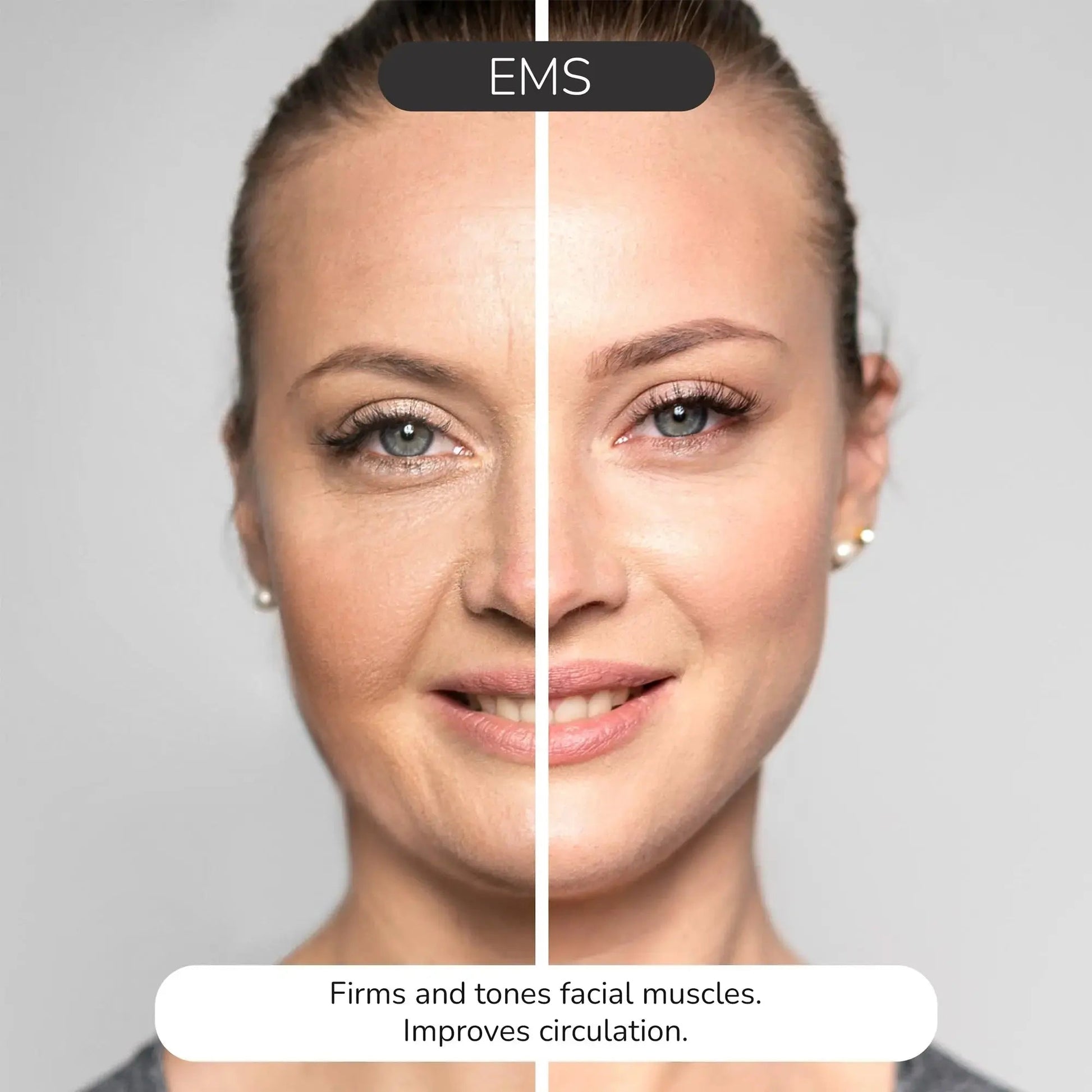 ODELYNE® ILLUME™ | Gesichtsmassagegerät | RF Radiofrequenz - Odelyne