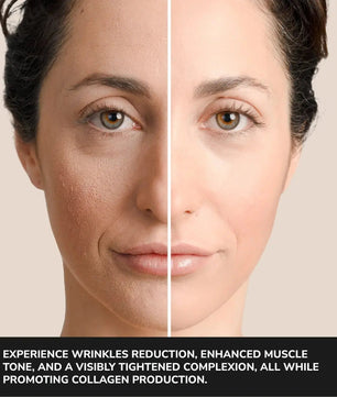 ODELYNE® ILLUME™ | Gesichtsmassagegerät | RF Radiofrequenz - Odelyne